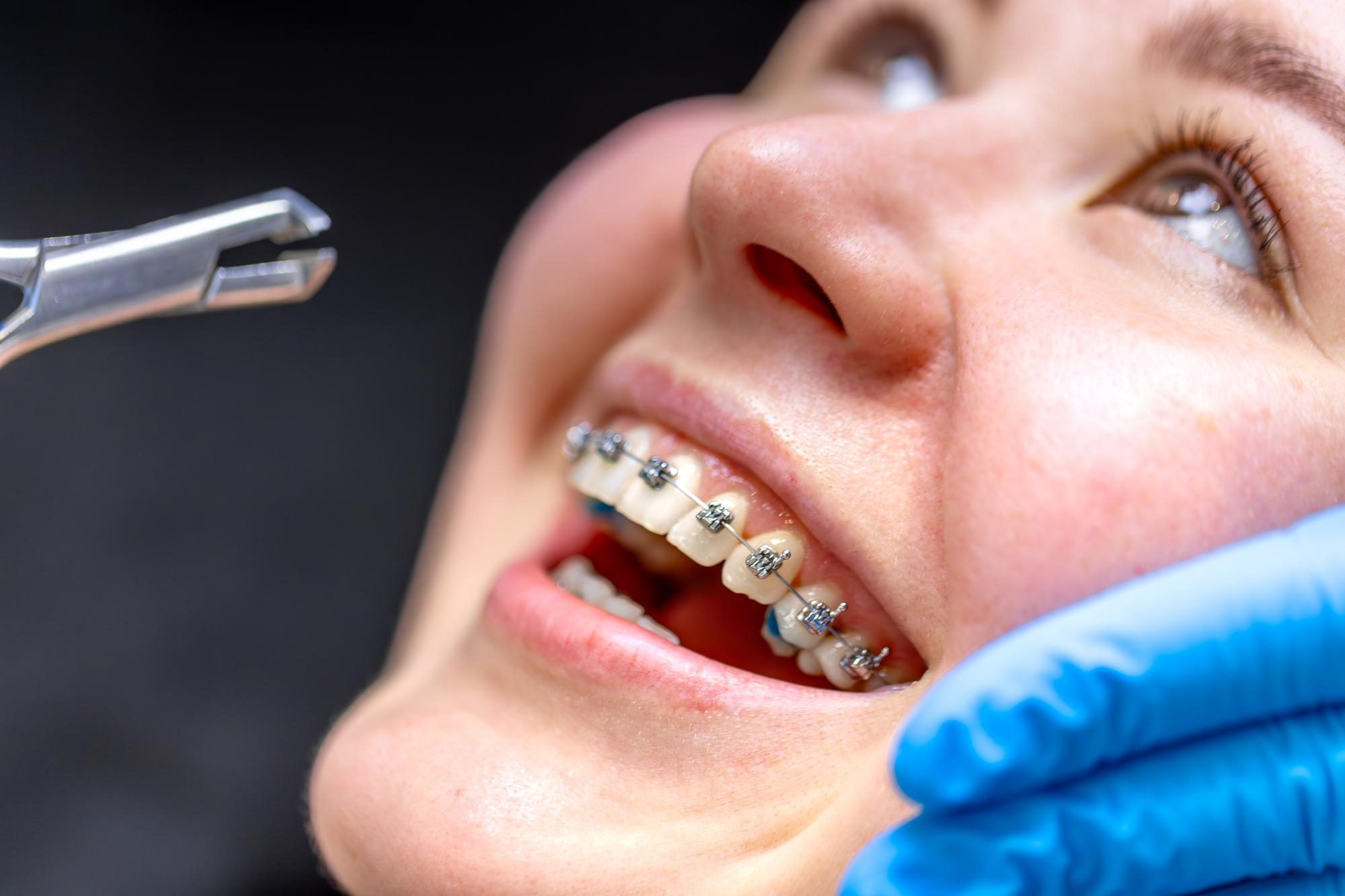 Orthodontist explaining clear aligners and braces treatment options to a patient