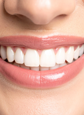 Cosmetic dentistry smile makeover