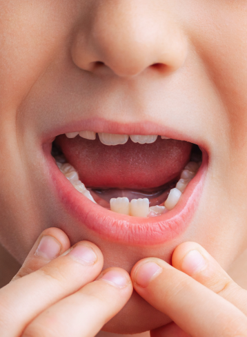 Pediatric dentistry for children